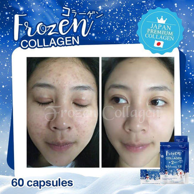 Gluta Frozen Collagen 2 In 1 Capsules ( 60 )